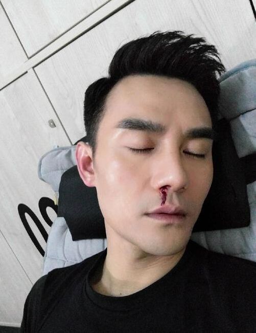 最近,你有没有发现,身边许多朋友都有流鼻血的情况!